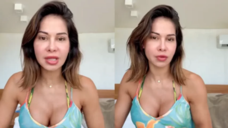 Especialista alerta sobre o risco do uso indevido de PMMA, procedimento feito por Maíra Cardi