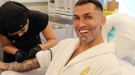 Por que o transplante de barba tem se tornado tendência de beleza entre os homens? Entenda