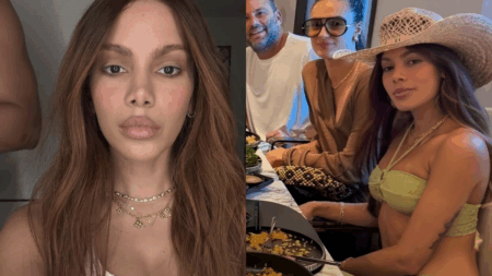 Quais são os procedimentos estéticos que Anitta fez no rosto? Qual são os procedimentos estéticos que Anitta fez no rosto?